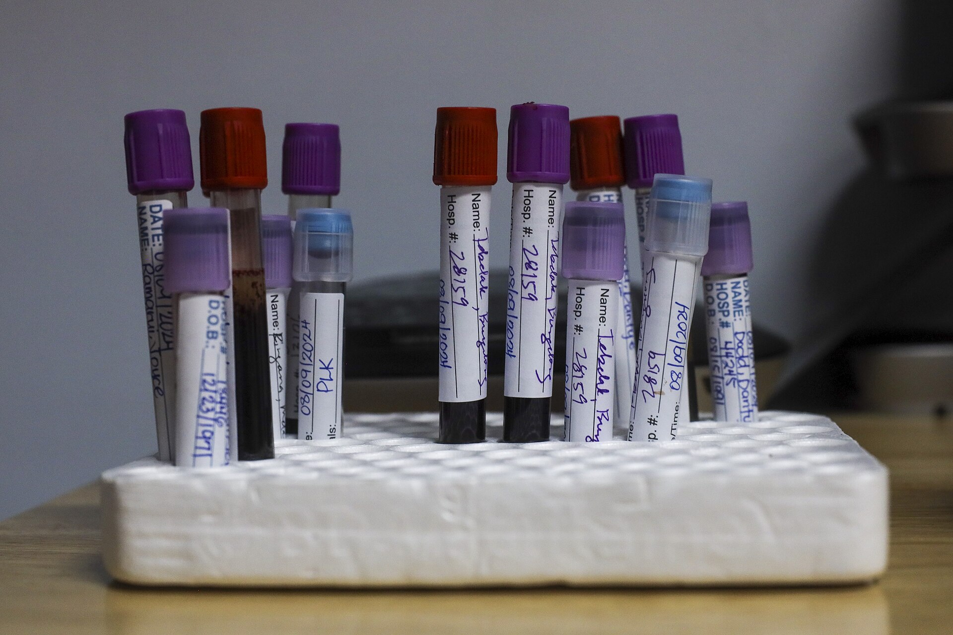 Labelled blood sample tubes with purple and red caps standing in a foam rack